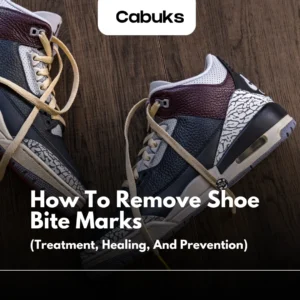 how rto remove shoe bite marks